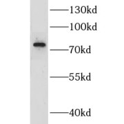 WB analysis of Jurkat cells, using ADRBK1 antibody (1/1000 dilution).