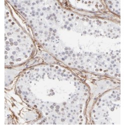 Glycogen Synthase Kinase 3 Beta (GSK3B) Antibody