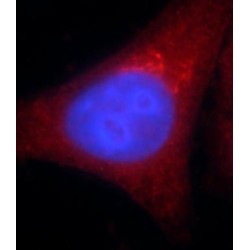 GSNOR,ADH5 Antibody