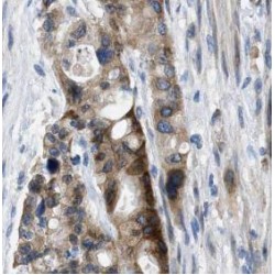 GSNOR,ADH5 Antibody