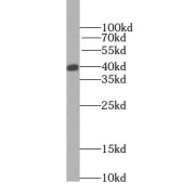 WB analysis of fetal human brain tissue, using GSNOR, ADH5 antibody (1/4000 dilution).