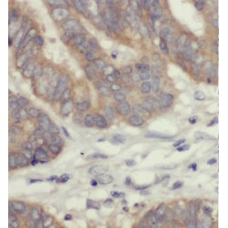 Eukaryotic Peptide Chain Release Factor GTP-Binding Subunit ERF3B (GSPT2) Antibody