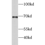 WB analysis of MCF7 cells, using GSPT2 antibody (1/500 dilution).