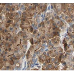 Glutathione S-Transferase A2 (GSTA2) Antibody