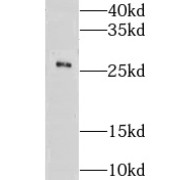 WB analysis of human brain tissue, using GSTA4 antibody (1/500 dilution).