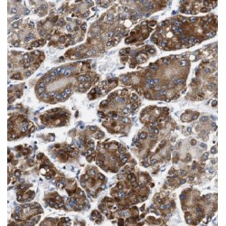 Glutathione S Transferase Kappa 1 (GSTK1) Antibody