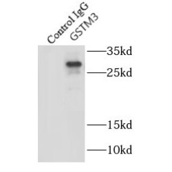 Glutathione S Transferase Mu 3 (GSTM3) Antibody