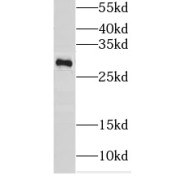 WB analysis of HepG2 cells, using GSTT2 antibody (1/1000 dilution).