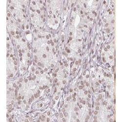 Transcription Initiation Factor IIA, Polypeptide 2 (GTF2A2) Antibody