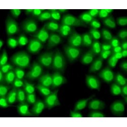 General Transcription Factor IIF, Polypeptide 1 (GTF2F1) Antibody