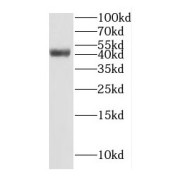 WB analysis of HepG2 cells, using GTF2H2C antibody (1/500 dilution).
