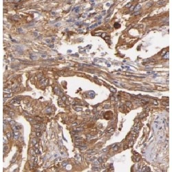 GTP Binding Protein 2 (GTPBP2) Antibody