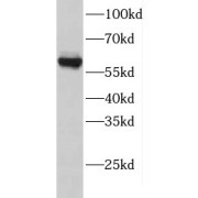 WB analysis of human kidney tissue, using GTPBP2 antibody (1/200 dilution).