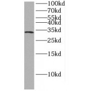 WB analysis of human liver tissue, using HAAO antibody (1/300 dilution).