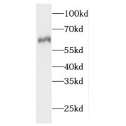 WB analysis of HeLa cells, using HACL1 antibody (1/500 dilution).