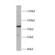 WB analysis of mouse kidney tissue, using HADHA antibody (1/1000 dilution).