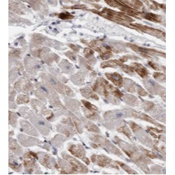 Trifunctional Enzyme Subunit Alpha, Mitochondrial (HADHA) Antibody