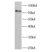 WB analysis of A375 cells, using HADHA antibody (1/1000 dilution).