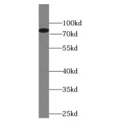 WB analysis of mouse liver tissue, using HAL antibody (1/1000 dilution).