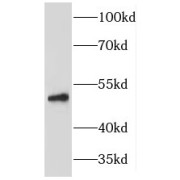 WB analysis of mouse liver tissue, using HARS antibody (1/500 dilution).