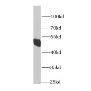 WB analysis of MCF7 cells, using HARS2 antibody (1/1000 dilution).