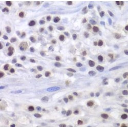 Histone Acetyltransferase Type B Catalytic Subunit (HAT1) Antibody