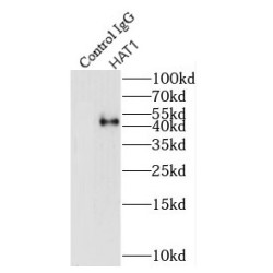 Histone Acetyltransferase Type B Catalytic Subunit (HAT1) Antibody