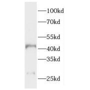 WB analysis of human brain tissue, using HAUS4 antibody (1/500 dilution).