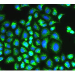 HCLS1-Associated Protein X-1 (HAX1) Antibody