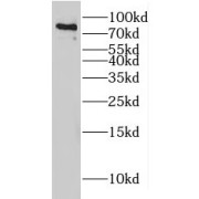 WB analysis of mouse testis tissue, using HCFC2 antibody (1/300 dilution).