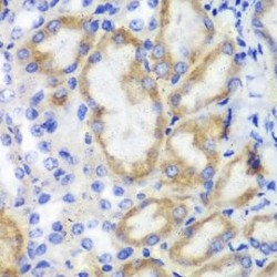 Hematopoietic Lineage Cell-Specific Protein (HCLS1) Antibody