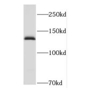 WB analysis of mouse brain tissue, using HCN4 antibody (1/500 dilution).
