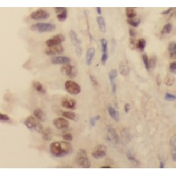 Histone Deacetylase 1 (HDAC1) Antibody