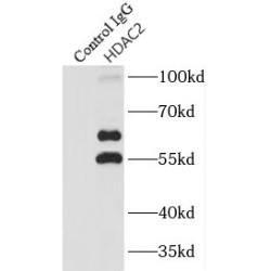 Histone Deacetylase 2 (HDAC2) Antibody