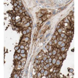 HDAC2-specific Antibody