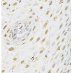 Histone Deacetylase 3 (HDAC3) Antibody