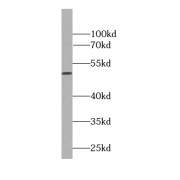 WB analysis of HL-60 cells, using HDAC3-specific antibody (1/200 dilution).