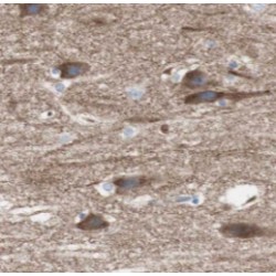 HDAC5-specific Antibody