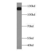 WB analysis of human brain tissue, using HDAC5 antibody (1/300 dilution).