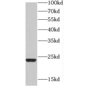 WB analysis of PC-3 cells, using HDDC2 antibody (1/1500 dilution).