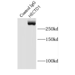 E3 Ubiquitin-Protein Ligase HECTD1 (HECTD1) Antibody