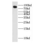 WB analysis of mouse brain tissue, using HECTD2 antibody (1/1000 dilution).