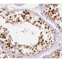 Hemogen (HEMGN) Antibody