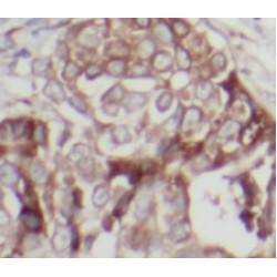 HER2 / ErbB2 Antibody