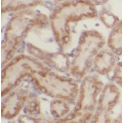 Beta-Hexosaminidase Subunit Beta (HEXB) Antibody