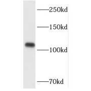 WB analysis of HeLa cells, using HGS antibody (1/800 dilution).