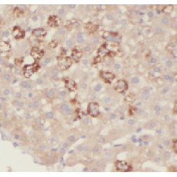 3-Hydroxyisobutyrate Dehydrogenase (HIBADH) Antibody