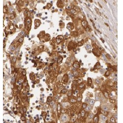 3-Hydroxyisobutyryl-CoA Hydrolase, Mitochondrial (HIBCH) Antibody