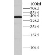 WB analysis of human brain tissue, using HIBCH antibody (1/500 dilution).