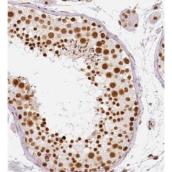 Hypermethylated In Cancer 1 Protein (HIC1) Antibody